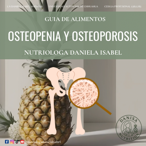 Osteopenia y osteoporosis - Tratamiento nutricional
